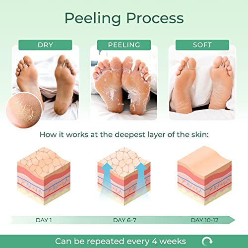 Маска за пилинг на крака - Авокадо Feet Peeling Mask 2 Pack - Дерматологически Тестван, Ремонт на Пукнатини